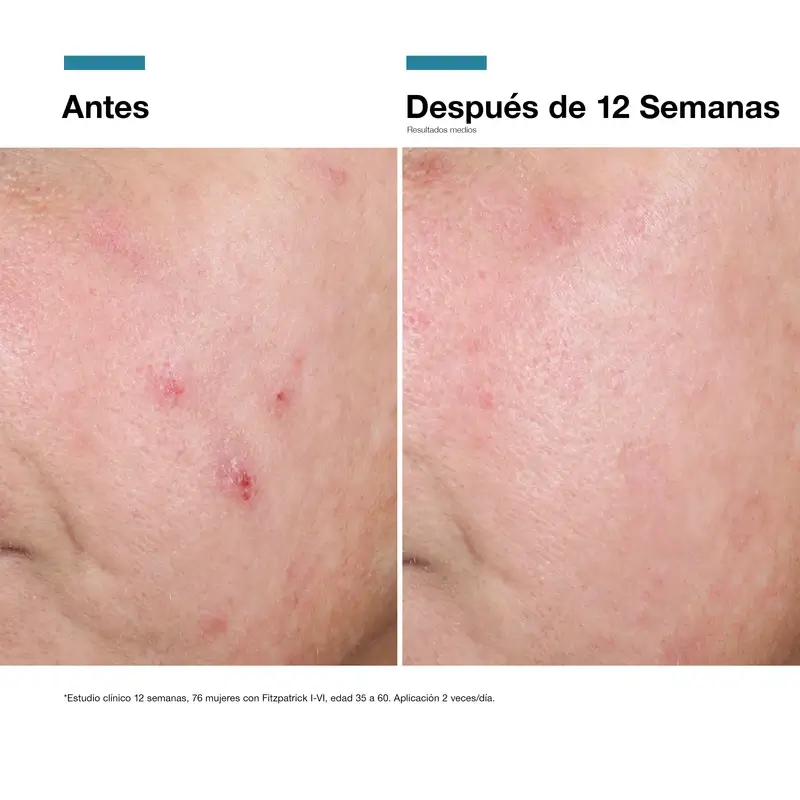 Imagen del producto 13